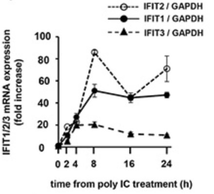 The expression of mRNA and protein for CXCL10.jpg